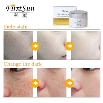 Freckle Removal Cream Dan Vlažilne Kreme Proti Freckle Zob Temen Madež Odstranite Krema Pjega Beljenje Svetlobe Za Nego Kože