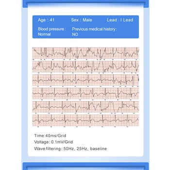 KAIHAI EKG PPG smart band zapestnica electrocardiograph srčnega utripa, krvnega tlaka, Srčnega utripa dejavnosti tracker smartband