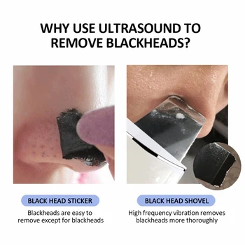 Ultrazvočno Obrazno Kožo Scruber LCD Zaslon Ion EMS Terapija Obraza Pomlajevanje Čistilo Blackhead Akne, Čiščenje Kože, za Nego Orodje